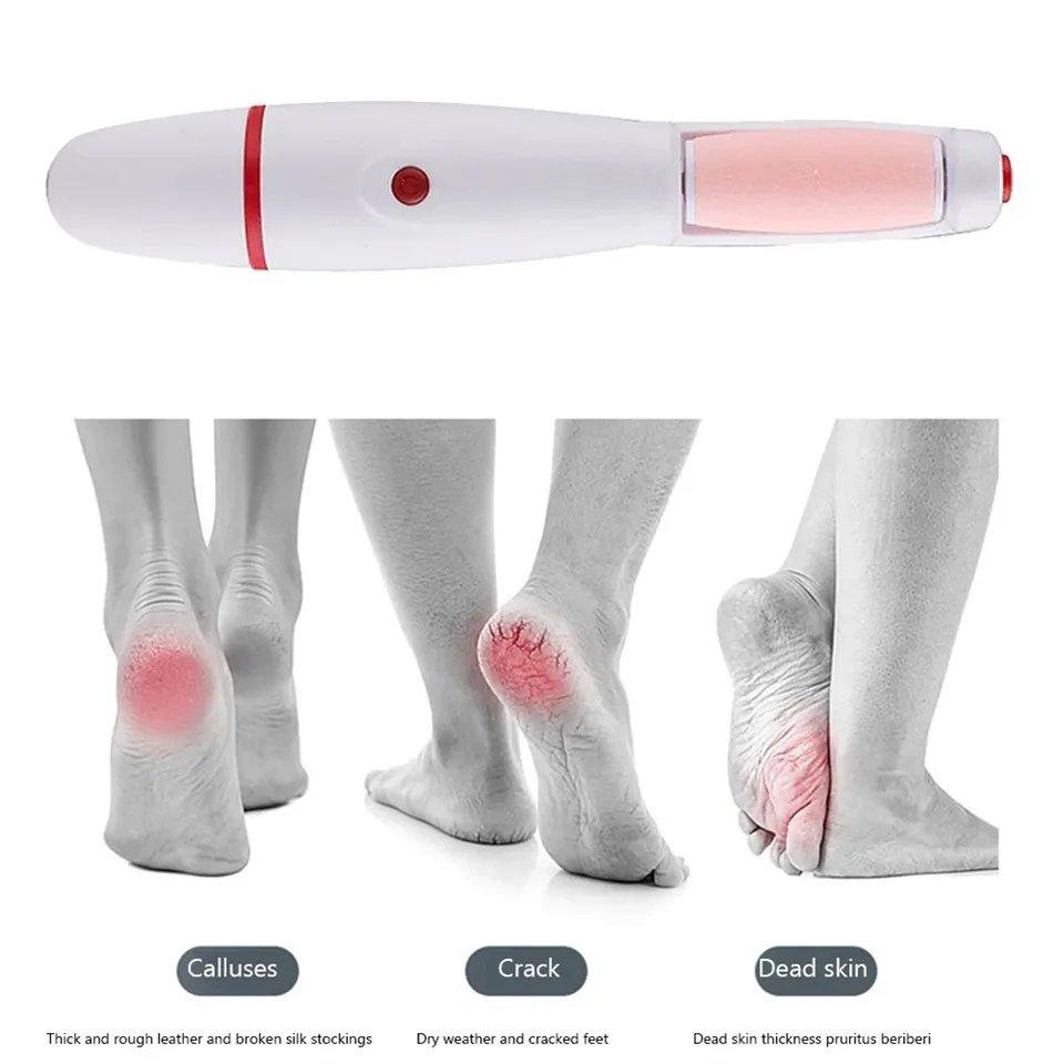 Electric Foot Grinder